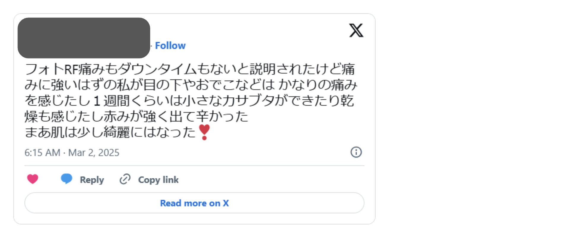 フォトRF 口コミ