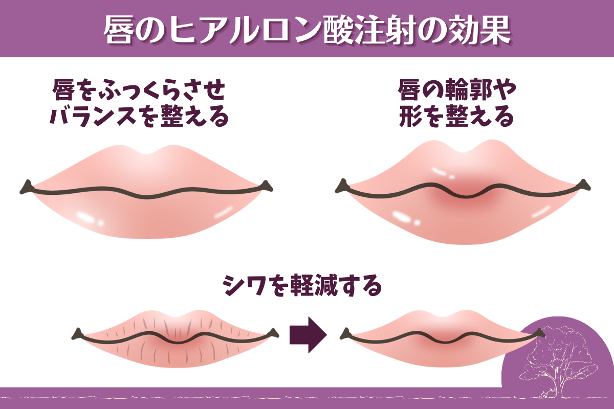 唇　ヒアルロン酸
