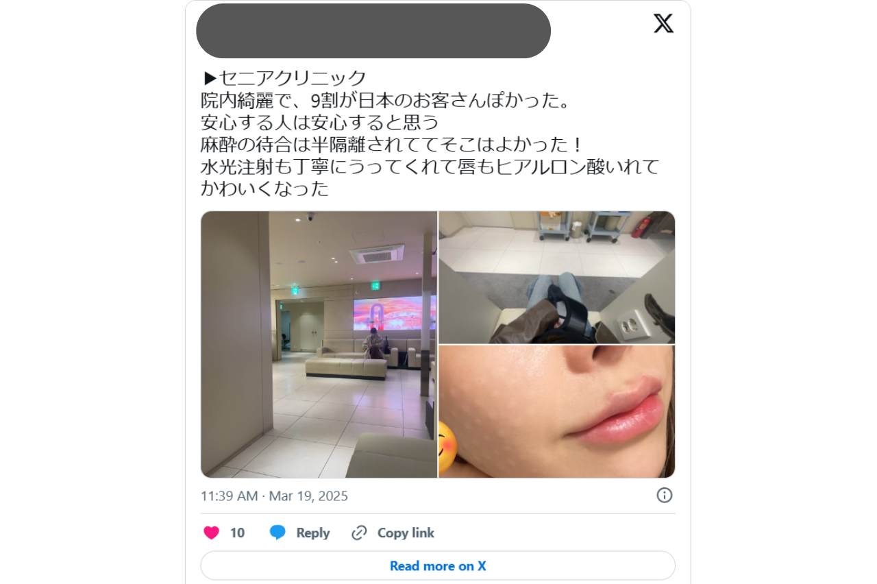 唇　ヒアルロン酸