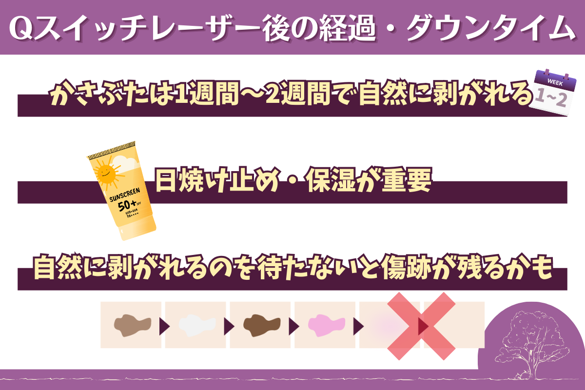 Qスイッチレーザー