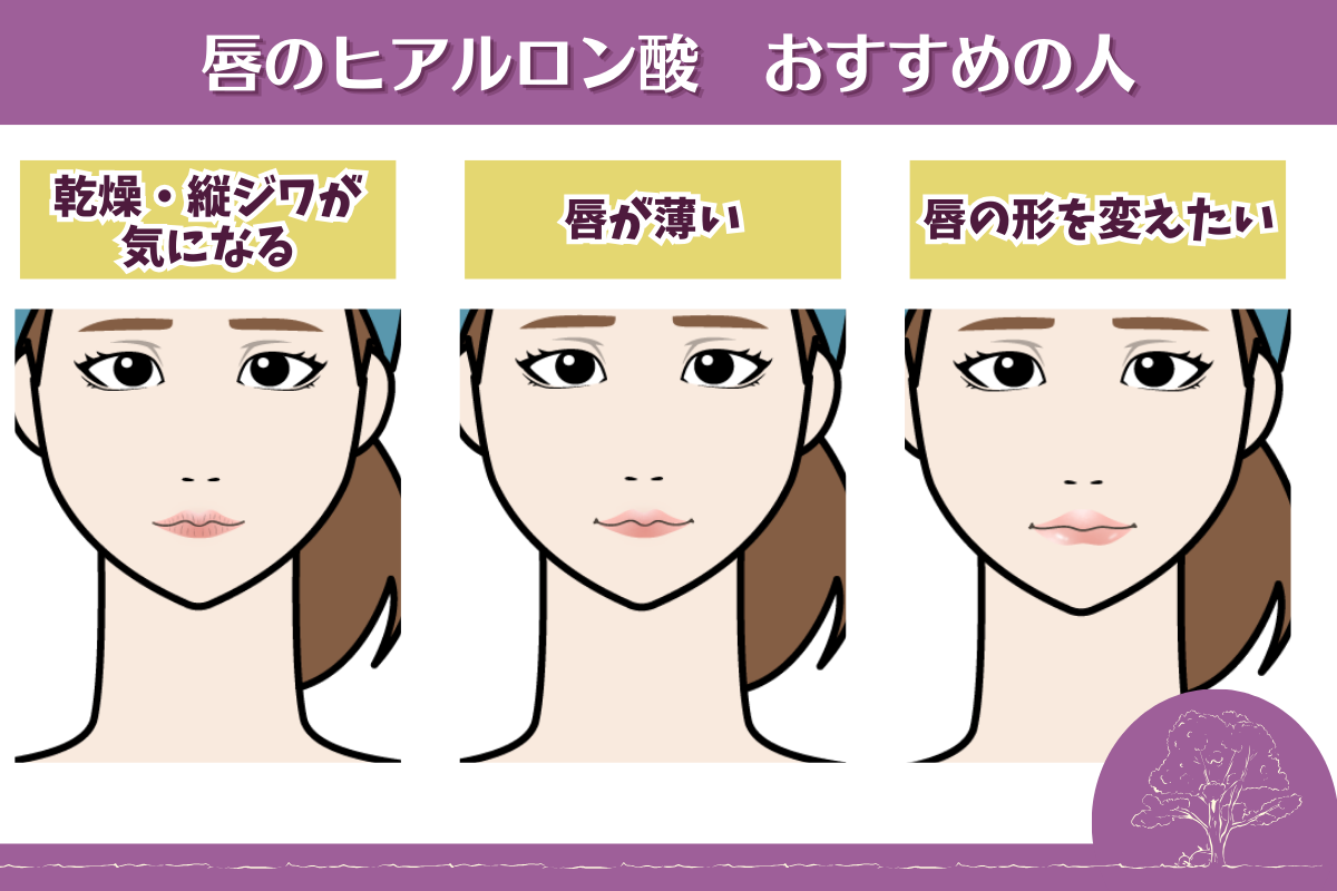 唇　ヒアルロン酸