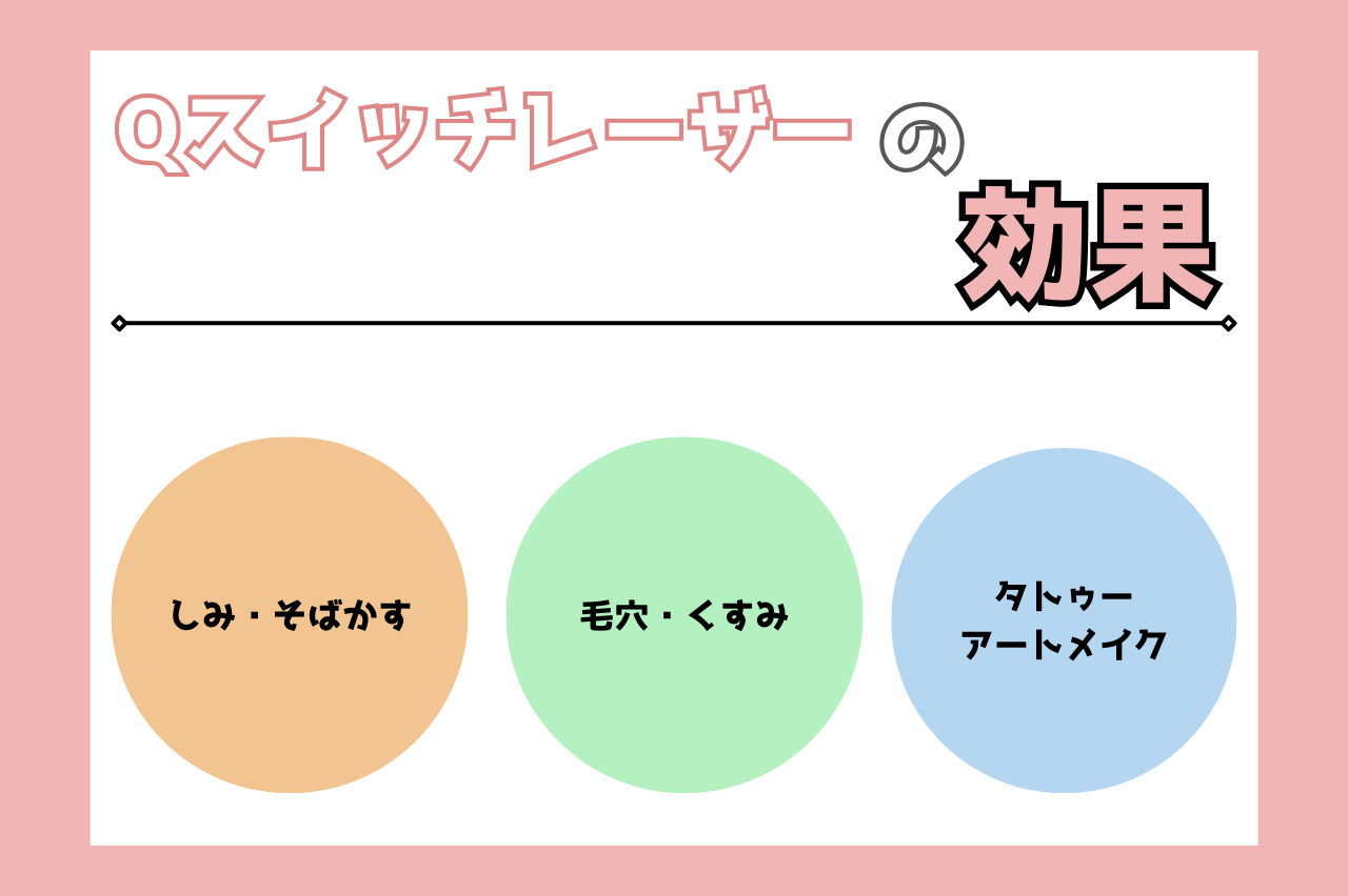 Qスイッチレーザー